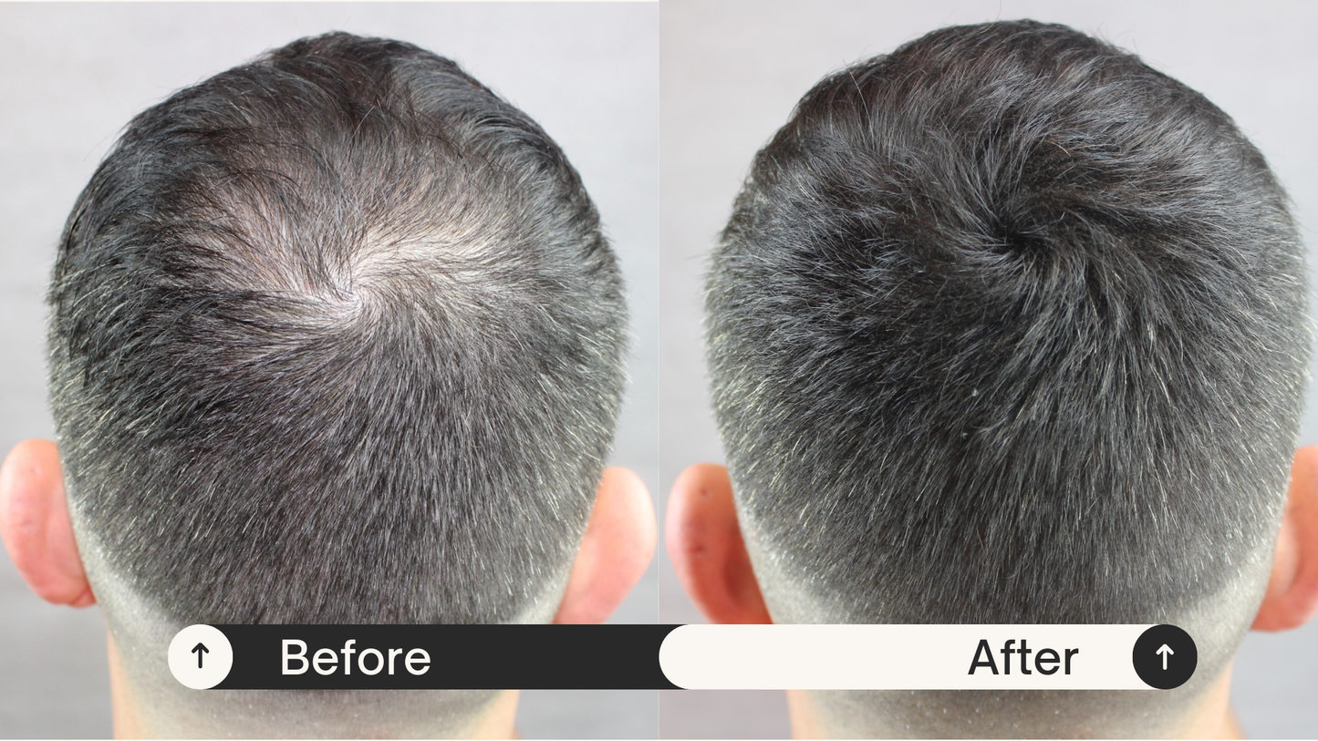 Keratin Hair Building Fibres