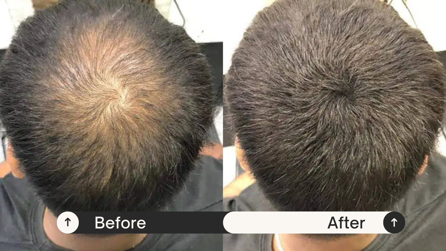 Keratin Hair Building Fibres